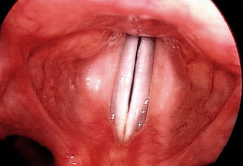 Как выглядит больное горло?
